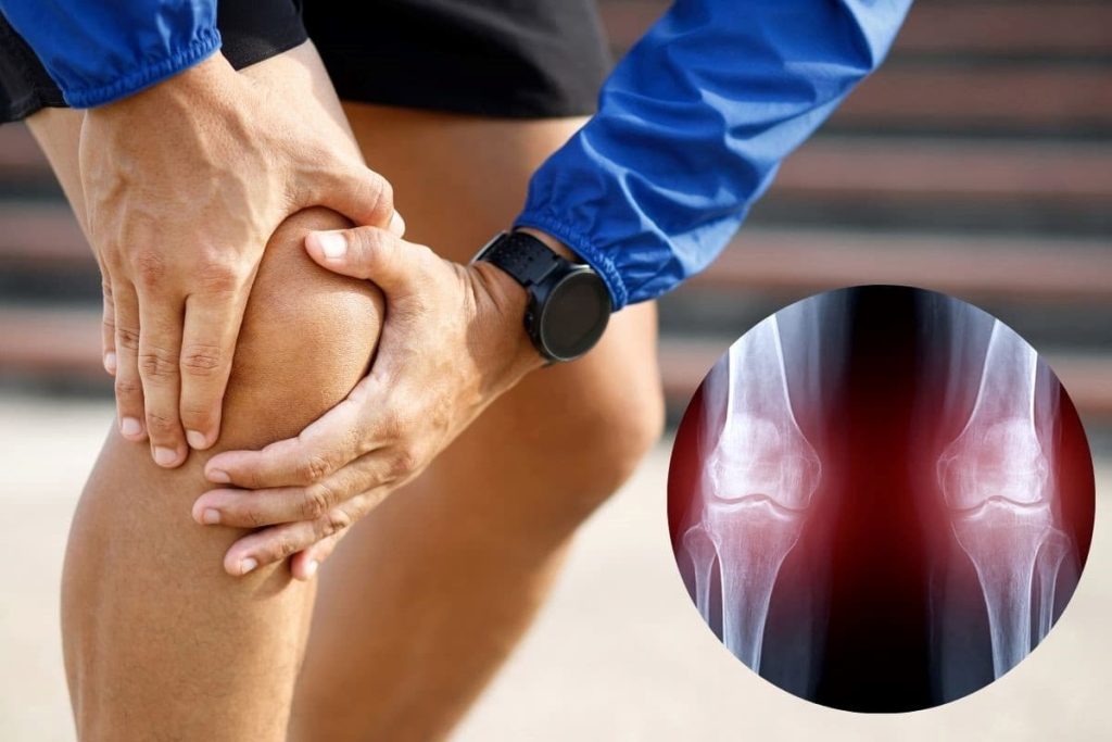 Tổn thương tại sụn là nguyên nhân chính gây ra các bệnh lý viêm khớp, thoái hóa khớp.
